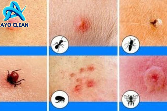 Salep Bengkak Digigit Serangga - Homecare24