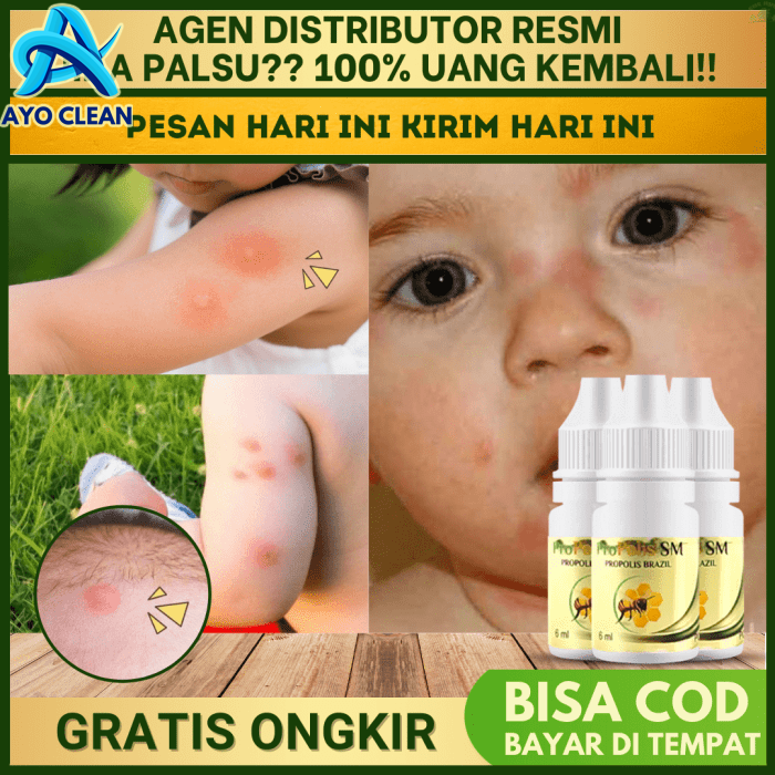 7 Cara Menghilangkan Bekas Gigitan Nyamuk pada Bayi