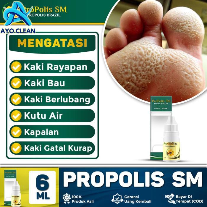 Obat Kaki Rayapan Dan Bau, Kaki Rayapan Berlubang, Telapak Kaki Bolong ...