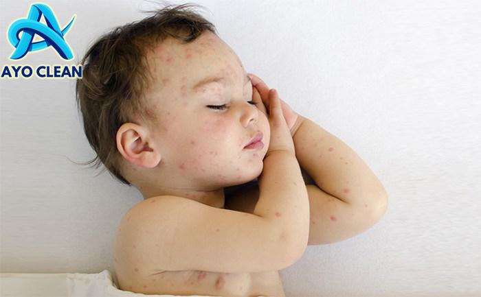 Atasi Bekas Luka Menghitam Pada Anak dengan 5 Cara Ini - Mama's Choice