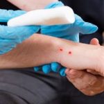 10 Pertolongan Pertama saat Digigit Ular Berbisa, Kamu Harus Tahu!