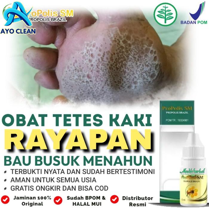 Jual Obat Salep Oles Untuk Telapak Kaki Gatal Rayapan dan Bau / Obat ...