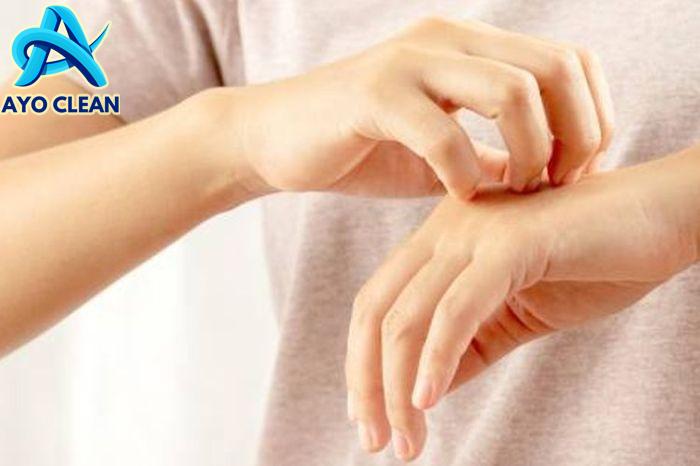 Cara menghilangkan gigitan nyamuk