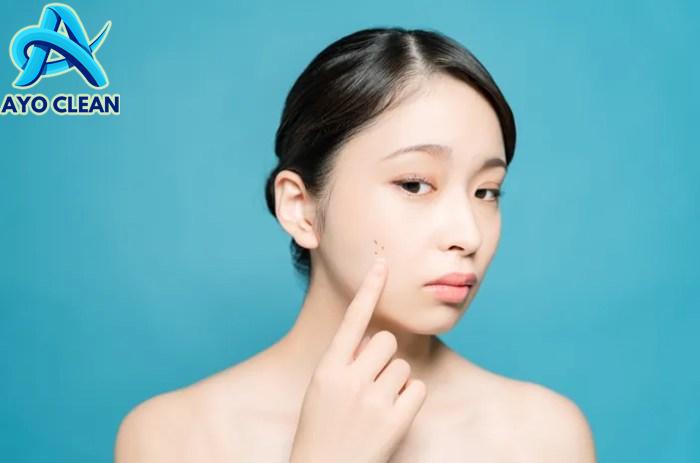 Kenali 4 Cara Menghilangkan Tahi Lalat dengan Aman