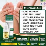 Cara Mengobati Kaki Rayapan Dengan Bawang Putih: Tips Dan Informasi ...