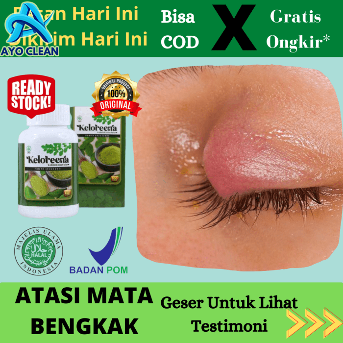7 Tips dan Cara Mengobati Mata Minus - Tokopedia Blog