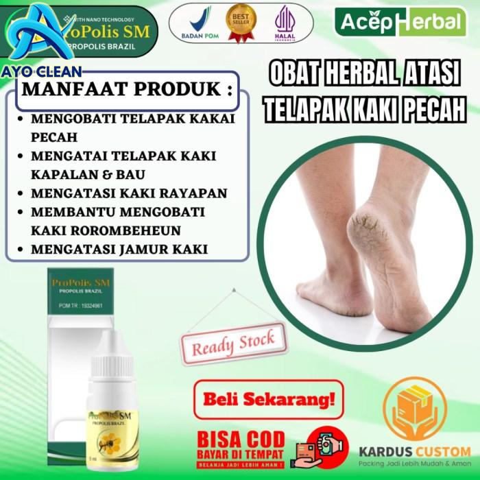 Jual Obat Oles Atasi Telapak Kaki Pecah Telapak Kaki Kapalan Dan Berbau ...