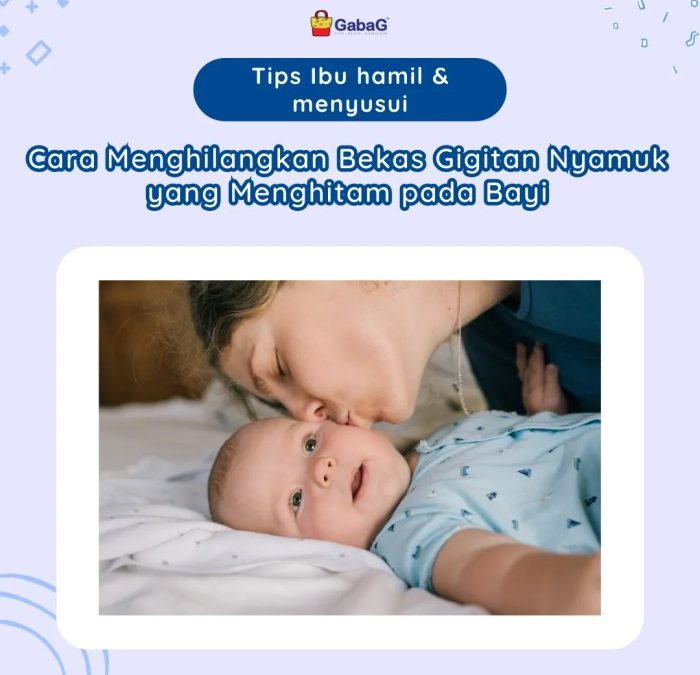 4 Obat Alami Rumahan Hilangkan Bekas Gigitan Nyamuk 0 : Foto Okezone ...