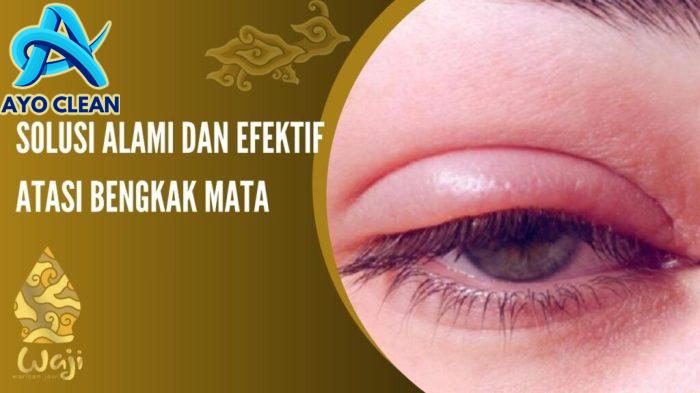 Safe Care Blog | Cara Mengatasi Gatal dan Bengkak Gigitan Serangga