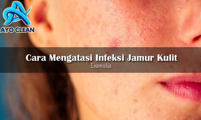 Cara Mngatasi Infeksi Jamur di Kulit | Eva Mulia Clinic