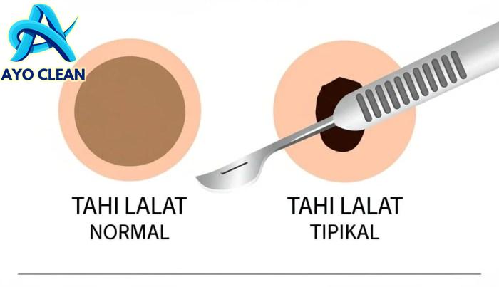11 Cara Mengusir Lalat: Bahan Alami Ini Ternyata Ampuh - Tokopedia 2023