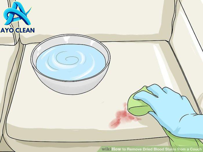 How to Remove Dried Blood Stains from a Couch: 15 Steps