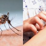 5 Cara Menghindari Gigitan Nyamuk dan Mencegahnya Datang