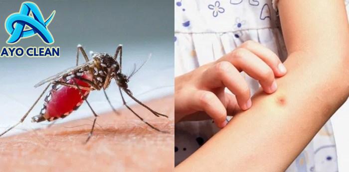 Cara menghilangkan bekas gigitan nyamuk secara alami, perlu tahu nih!