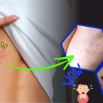 9 Cara Membasmi Kutu Kasur Spring Bed Terbukti Dijamin Ampuh