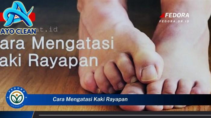 Cara mengobati kaki rayapan dengan air garam