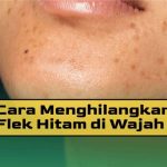 Cara Menghilangkan Flek Hitam di Selangkangan agar Mulus Kembali - Stylo