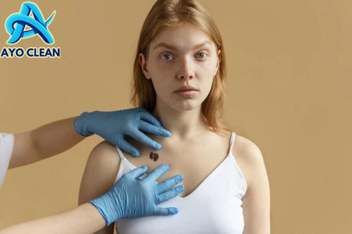 13 Cara Menghilangkan Tahi Lalat Hidup dengan Tindakan Operasi