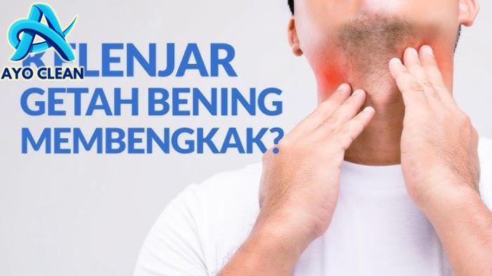 5 Cara Mengobati Pembengkakan Kelenjar Getah Bening Dengan Pijatan ...