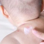 Cara mengatasi gigitan nyamuk pada bayi