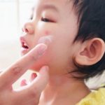 √ Cara Menghilangkan Bekas Luka Gigitan Nyamuk Pada Kulit Si Kecil